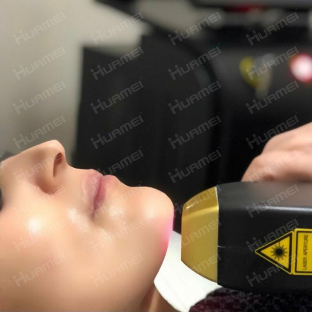 huamei diode laser hair removal machine factory