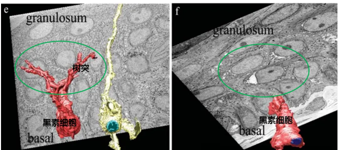 Huamei Q switched Nd YAG laser tattoos removal beauty machine Pico laser machine